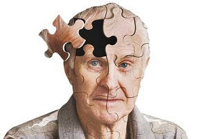 علایم اولیه هشدار دهنده آلزایمر