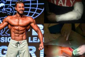 حمله وحشتناک با قمه و چاقو به قهرمان بدنسازی ایران