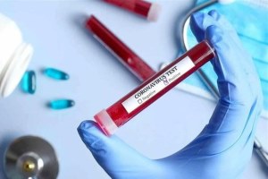 هنوز مبارزه سنگین با کرونا را پیش رو داریم