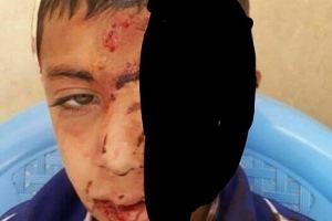 سقوط دانش‌ آموز خراسانی از کوه به + عکس