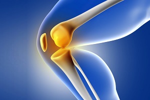 برای کم شدن دردهای مفصلی چه بخوریم؟ مواد غذایی یا مکمل تقویتی استخوان؟