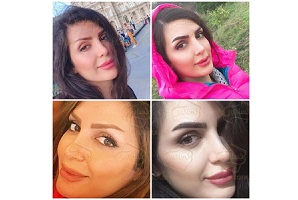 بهترین کلینیک و دکتر کاشت ابرو و مو در ایران