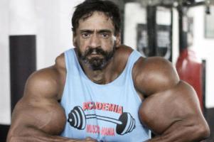 عکس های عجیب از تزریق روغن به بدن برای داشتن اندام ورزشکاری!