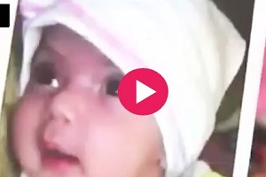 کودک 6 ماهه ای که سرش همچنان رشد می کند