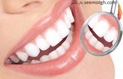 همه آنچه درباره ارتودنسی باید بدانید