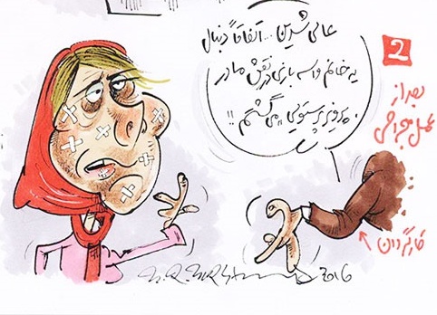 بازیگر زن پس از خارج کردن پروتز ها