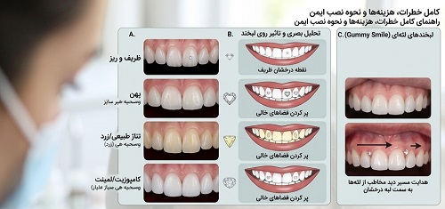 انواع نگین دندان