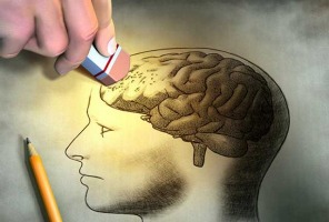 آلزایمر