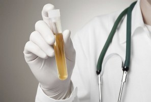 همه چیز درباره سوزش ادرار