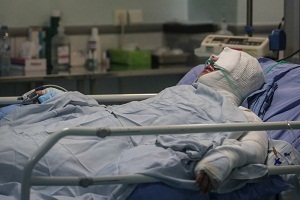 وزیر بهداشت در حال معاینه قربانی اسیدپاشی + عکس
