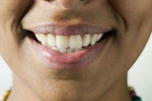 آیا مسواک زدن برای پیشگیری از پوسیدگی دندان کافی است؟
