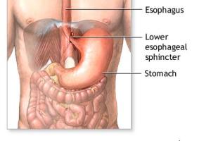  التهاب حاد روده :از چه غذاهایی باید پرهیز کرد و چه غذاهایی را باید در الویت قرار داد؟